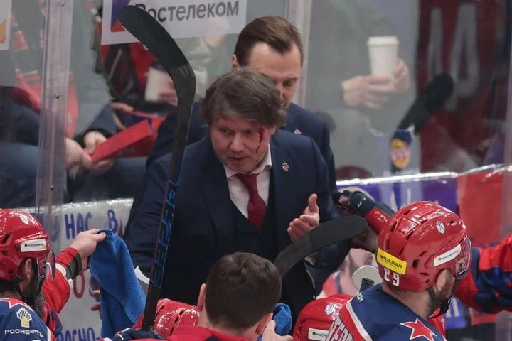 Тренер ЦСКА получил рассечение от попадания шайбы Тренер ЦСКА получил рассечение от попадания шайбы