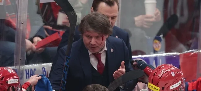 Тренер ЦСКА Якубов о попадании шайбы в лицо: «Успел отвернуться, так бы попала в глаз» Тренер ЦСКА Якубов о попадании шайбы в лицо: «Успел отвернуться, так бы попала в глаз»